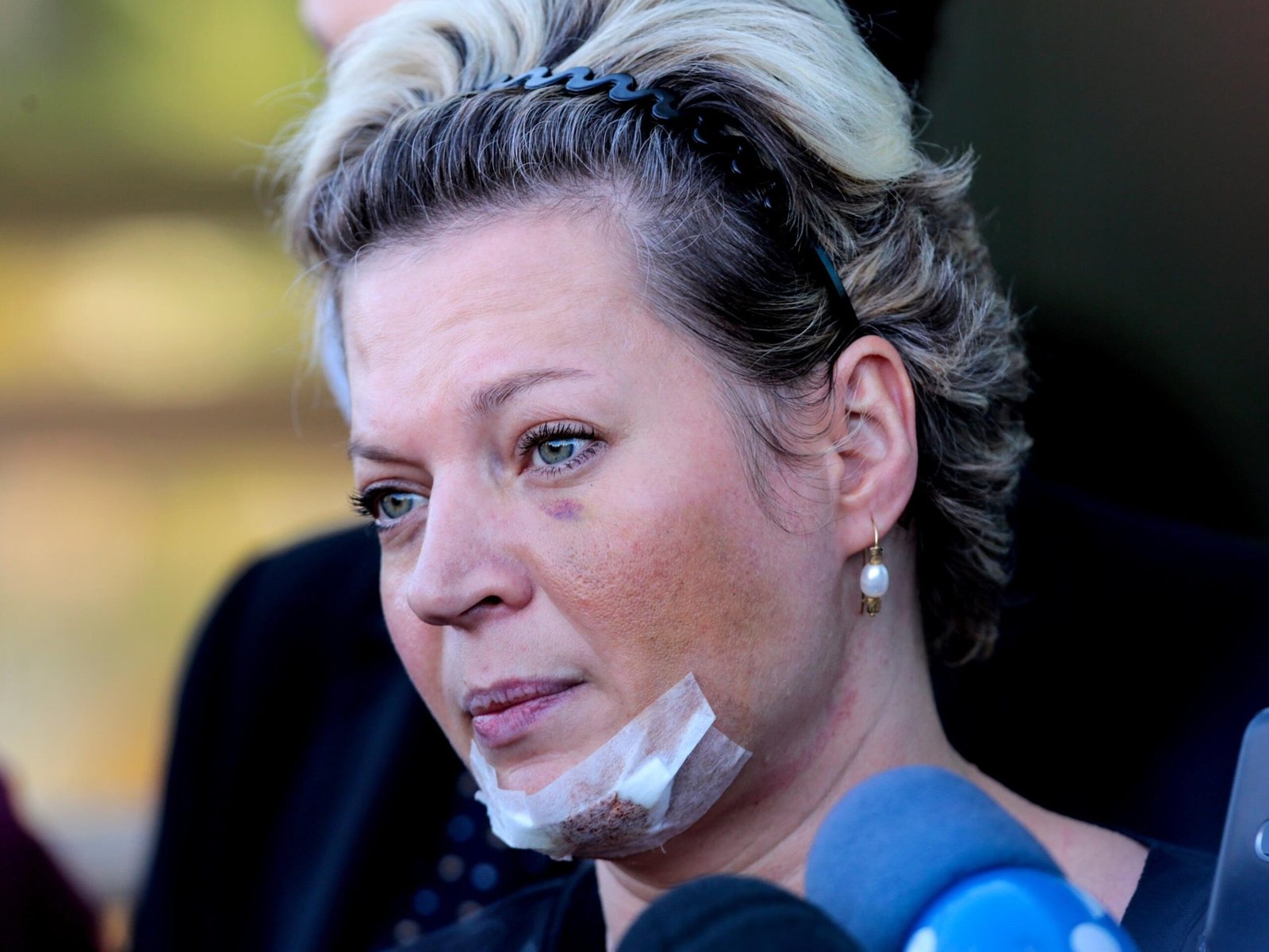 Joice Hasselmann sofreu queda e não houve agressão, diz polícia