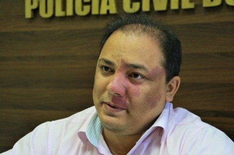 Chico Lucas mantém Luccy Keiko na Delegacia-Geral de Polícia Civil
